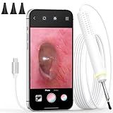 ScopeAround Otoscope, Ear Camera 3.9mm Ultra-Thin with 6 LED Lights, Digital Otoscope with Ear Wax Removal Tool, USB Plug & Play Ear Wax Camera Compatible with iPhone 15/Android