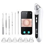 Facial Pore Blackhead Remover Vacuum, 1080P Camera Blackhead Remover, 20x Zoom, 8 LEDs ＆ 3 Suction Modes, 800mAh Battery & USB - 6 Heads Pore Cleaner Kit for Women&Men(Black)
