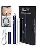 Visual Blackhead Remover Tools with Camera,Pimple Popper Extractor Tool Kit with Camera 20X 1080P Pore Cleaner Acne Comedone Whitehead Extractor Kit for iPhone/Android (Blue)