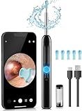 Ear Wax Removal Tool Camera, 1080P HD Scope and 6 LED Lights, Ear Cleaner with Camera, Ear Cleaning Kit - Earwax Remover Tool with 5 Spoon (Onyx)