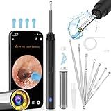 Ear Wax Removal, 1296P HD Earwax Removal Tool with Camera, Wireless Ear Cleaner with 6 LED Lights Built-in WiFi IP67 Waterproof for iOS & Android