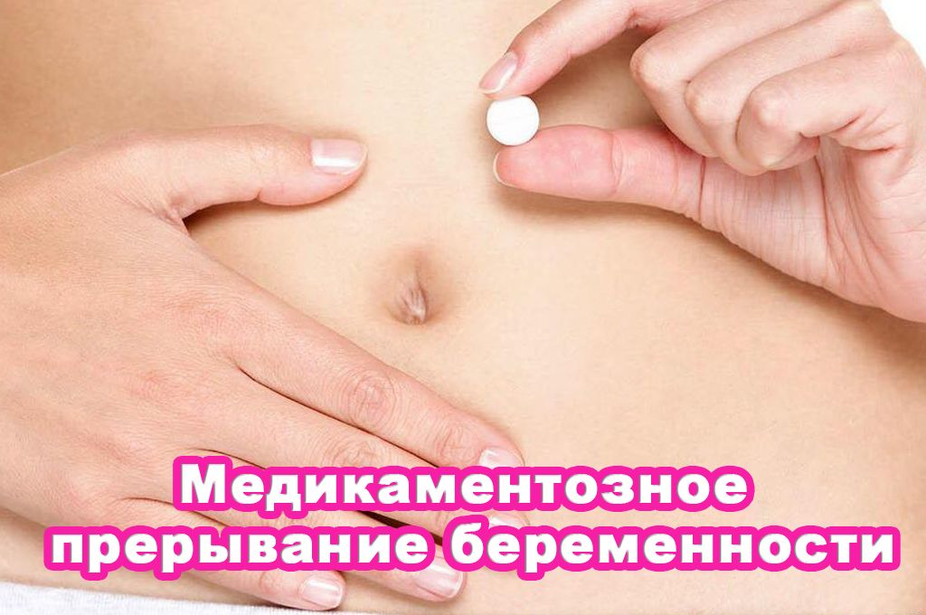 Медикаментозное прерывание беременности image